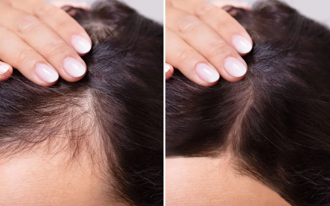 Cystine B6 Bailleul : guide complet sur ce traitement pour cheveux et ongles