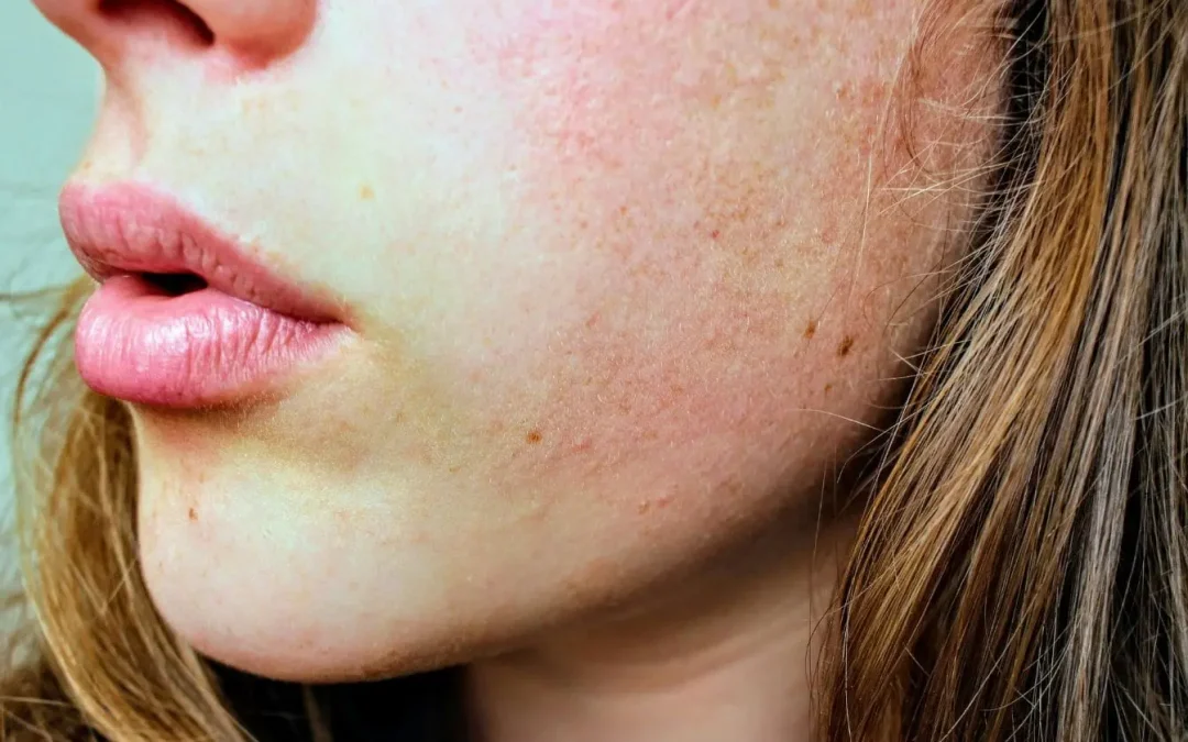 Allergie au gluten et symptômes chez l&rsquo;adulte : comment identifier une intolérance ?