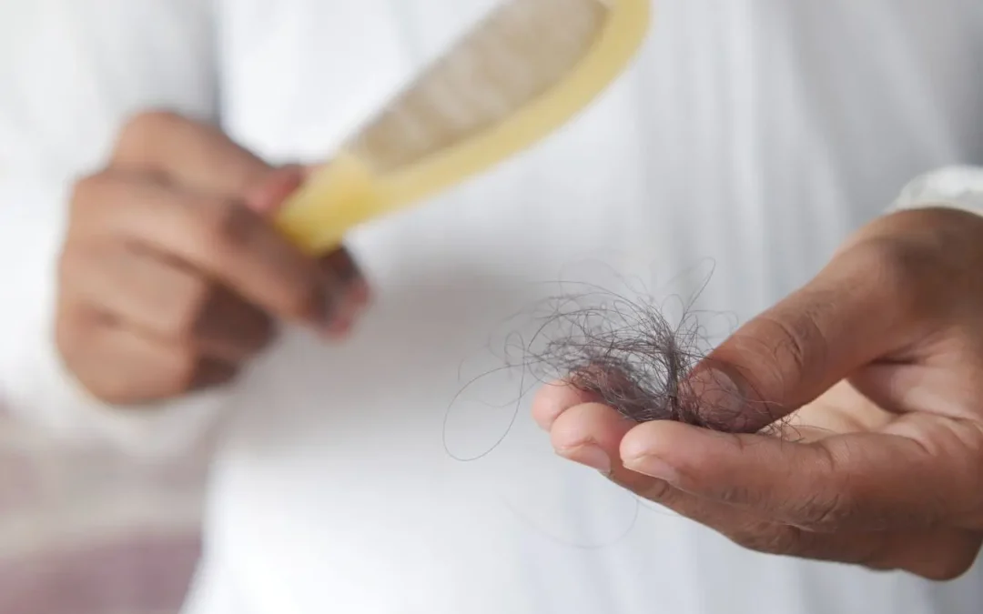 Chute de cheveux et carence alimentaire : identifier et traiter les manques nutritionnels