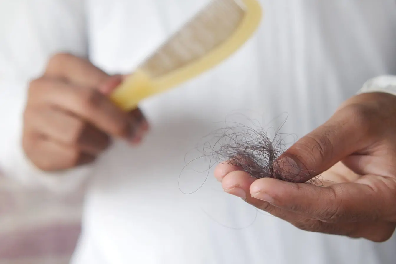 Main tenant touffe de cheveux tombés avec peigne jaune, image illustrant la chute de cheveux liée à une carence alimentaire.