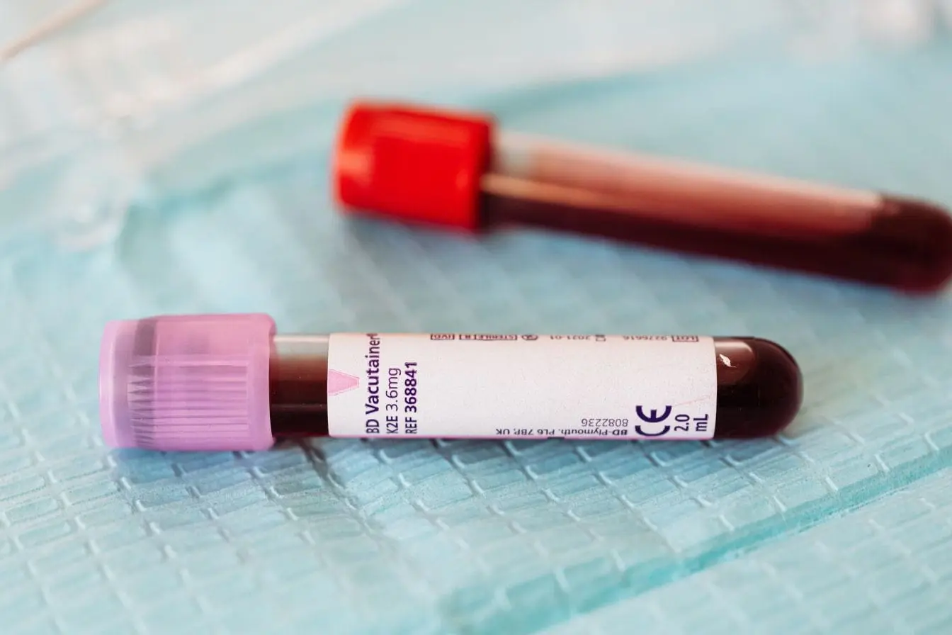 Tubes de prélèvement sanguin posés sur surface médicale, image illustrant la lecture des résultats de bilan sanguin.