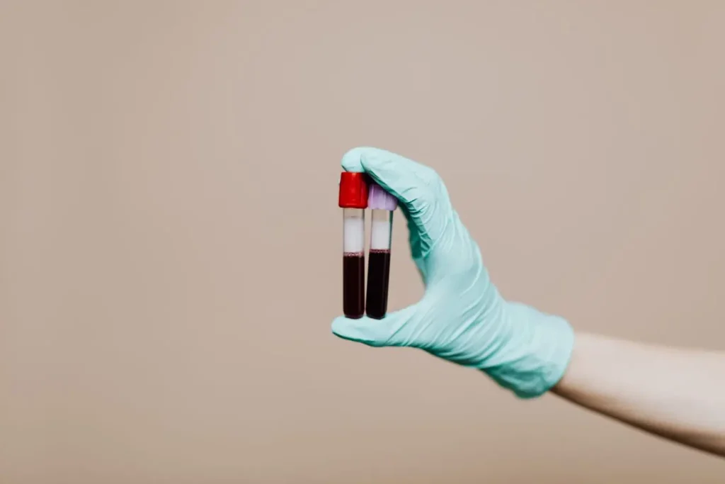 Main gantée tenant deux tubes sanguins, image illustrant la lecture des résultats de bilan sanguin en laboratoire.
