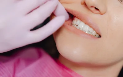 Bruxisme nocturne : quelles sont les causes du grincement de dents la nuit ?