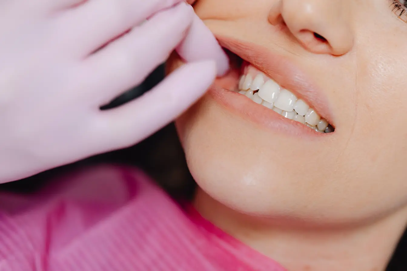 dents Gros plan sur bouche examinée par dentiste, image qui illustre le bruxisme nocturne et les causes du grincement de dents la nuit.