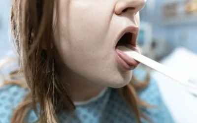 Langue blanche : quelles sont les causes et la signification de ce symptôme ?