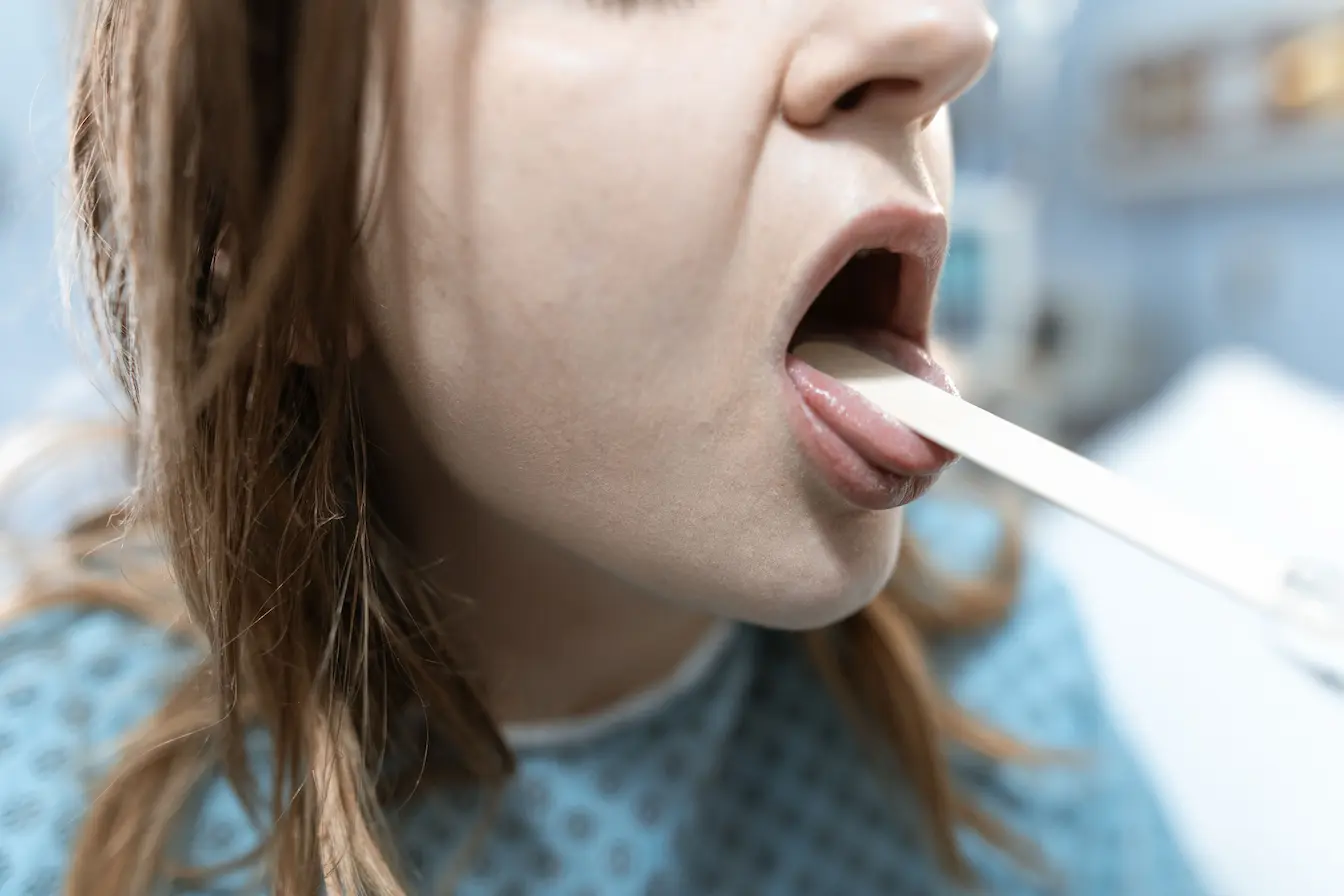 Gros plan sur bouche ouverte avec abaisse-langue, illustration des examens médicaux liés aux causes d’une langue blanche.
