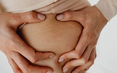 Cellulite : quels remèdes naturels pour lisser la peau et déstocker les graisses ?