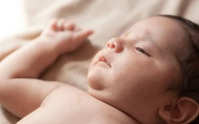 Eczéma du bébé : quels sont les remèdes naturels pour le soulager ?