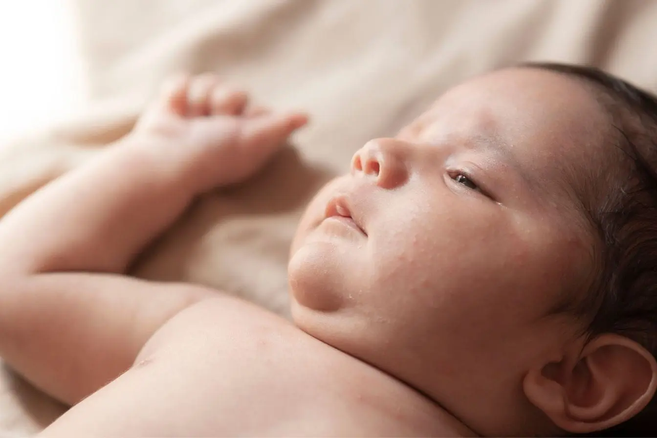 eczéma du bébé Bébé allongé sur surface douce avec petites rougeurs visibles sur la peau, symbole des symptômes d’eczéma nécessitant des soins naturels.